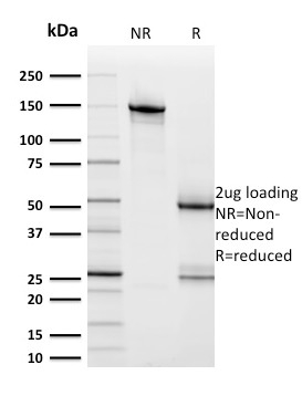 Data from SDS-PAGE analysis of Anti-HER2 antibody (Clone ERBB2/2453). Reducing lane (R) shows heavy and light chain fragments. NR lane shows intact antibody with expected MW of approximately 150 kDa. The data are consistent with a high purity, intact mAb.